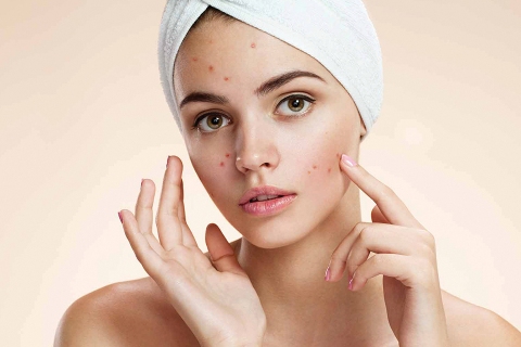 Top 3 Best Acne & Pimples Spot Removal Cream in India 2024