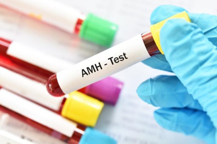 Anti-Mullerian Hormone Test