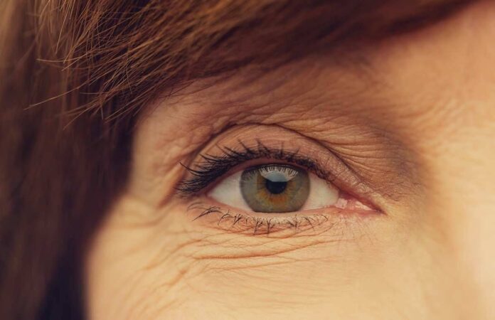 Thyroid Eye Disease