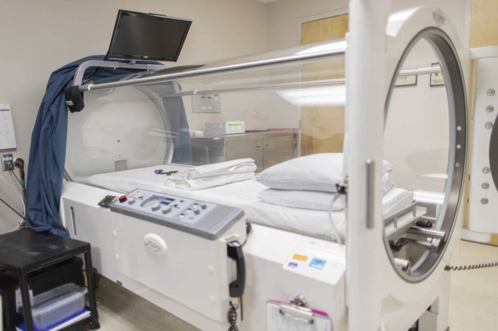 Why Consider Hyperbaric Oxygen Chambers